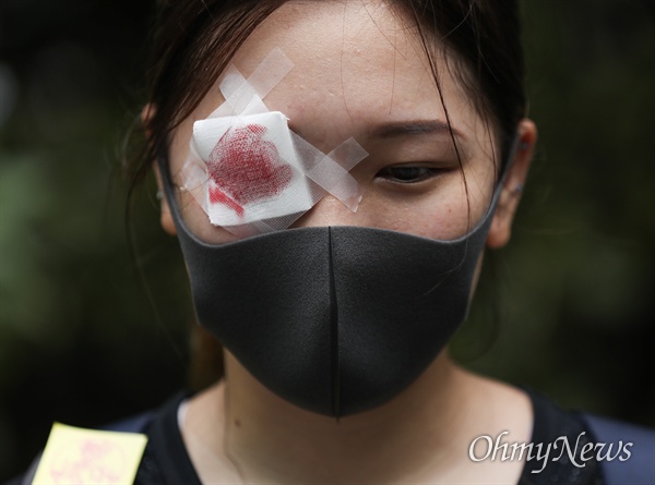 과잉진압 항의하는 홍콩시민들 중국 정부의 강경진압 경고에도 불구하고 18일 오후 송환법에 반대하는 홍콩시민들이 빅토리아 공원을 가득 채워 집회를 성사시킨 뒤, 폭우 속에 거리행진을 하고 있다. 경찰의 고무총탄 사용으로 눈을 다친 시민을 상징하며 안대를 한 시민이 집회에 참여하고 있다.