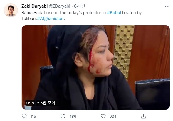 탈레반 대원의 폭행을 당한 여성 인권 시위대의 부상을 알리는 트위터 계정 갈무리.