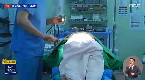 지난 5월 24일 '인천21세기병원의 대리수술 의혹'을 보도한 MBC 보도 화면.