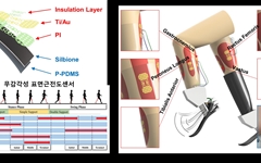 하지절단 환자 위한 신기술로 '로봇 의족 제어 센서' 개발