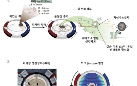 파킨슨병 환자에 희소식... 뇌수술 없이 '자기장'으로 치료한다