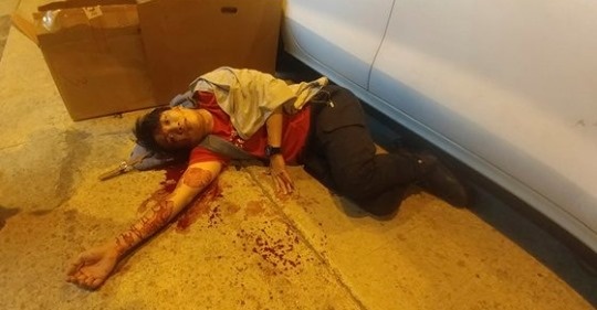  홍콩 민주화 시위를 주도해온 지미 샴 민간인권전선 대표가 지난 10월 16일 밤 정체불명의 괴한들로부터 쇠망치 공격을 당한 모습.