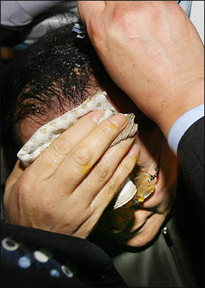 지방순회 중인 무소속 이회창 대선후보가 13일 오후 대구 서문시장 방문 중 한 시민이 던진 계란에 맞아 손수건으로 얼굴을 닦고 있다.
