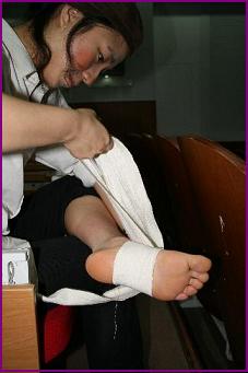 송미희씨(21)는 공연 연습중 다리를 다쳐 절뚝거렸지만, 압박 붕대를 감고 연극에 임했다.