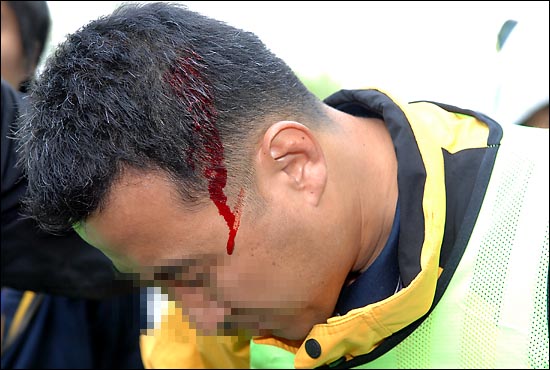 한 일간지 사진기자가 중국인 유학생쪽에서 날아온 물체에 맞아 머리에서 피를 흘리고 있다.