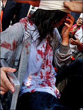 6월 1일 경복궁 동십자각 앞에서 경찰 방패에 찍혀 머리에 출혈을 일으킨 대학생 김선미씨(25세)의 모습.
