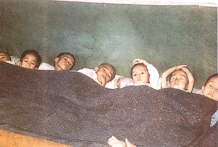 영양실조 상태의 북한아이들.
