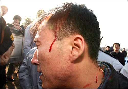자유북한운동연합 소속 탈북자가 휘두른 스패너에 머리를 맞은 한 진보연대 회원의 머리에서 피가 흐르고 있다.