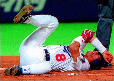 부상, 선수생활의 갈림길 1998년 6월 23일, 한신 투수 가와지리의 공이 이종범의 팔꿈치뼈를 부러뜨렸다. 한일 야구사의 작지 않은 사건이었다.