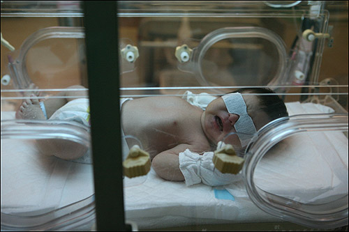 아이는 황달로 태어난 지 1주일만에 병원에 입원했다. 모유를 먹는 아기의 경우, 모유양이 부족해 황달증상이 나타나곤 하는데 생후 7일 이후에도 황달 수치가 높을 때는 진찰을 받아야 한다. 신생아 황달은 특수형광등을 켠 인큐베이터 안에서 광선치료로 진행된다. 