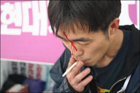 담배를 피고있는 임용현씨는 21일 용역 경비업체에게 폭행을 당했다.