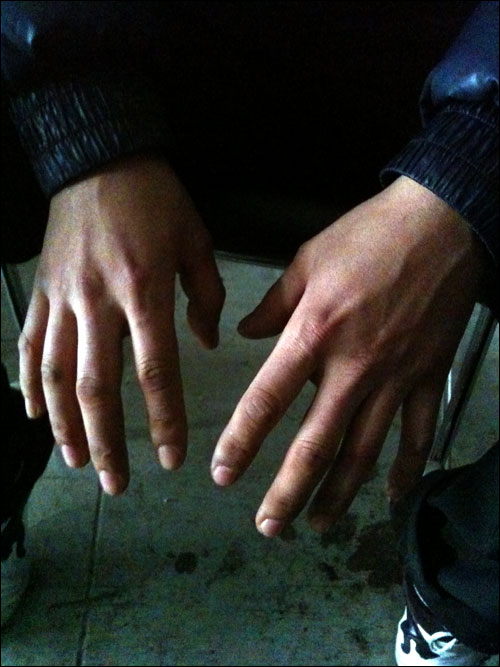 울산 현대차 제1공장을 점거한 채 정규직 전환을 요구하고 있는 비정규직 노동자 장윤석(가명. 33)의 손. 