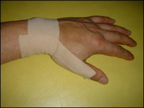 엄지 손가락 쪽 손목 부근이 동전 크기 만큼 부풀어 오르면서 통증이 심했습니다. 2주 된 지금도 손이 부어 오르고 통증이 있습니다.
