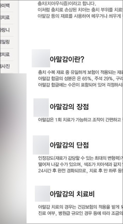 '아말감'이란 검색어를 넣어 검색한 결과, 서울 한 번화가의 치과 홈페이지 충치치료 안내 페이지를 캡쳐한 것이다.