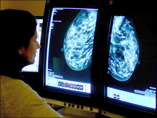 영국 NHS의 한 컨설턴트가 유방 촬영 사진을 보며 유방암 여부를 가려내고 있다. 