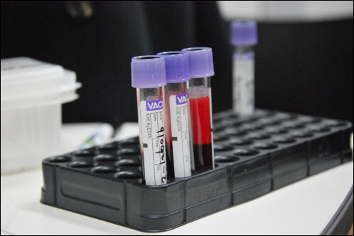 조직적합성검사를 위해 채취된 혈액샘플