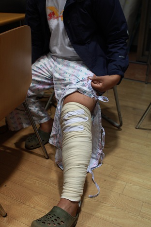 한 대학생이 해군의 폭행으로 다리가 다쳐서 깁스를 하고있다.