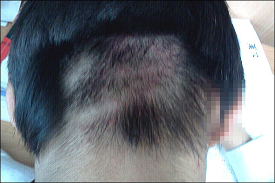 학교 두발단속에서 교사에게 가위로 머리카락이 잘린 학생의 모습. (자료 사진)