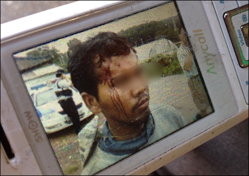 캄보디아 노동자 뜨엄 멍씨가 사업주의 폭행으로 이마에 피를 흘리고 있다. 해당 사업주는 뜨엄 멍씨가 사업장을 이탈하기 위해 자해를 했다고 주장했다.