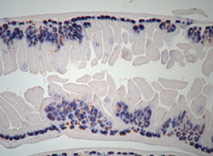 네이처 지에 실린 연구와 관련된 구본경 박사의 실험 사진: 돌연변이 생쥐 (Rnf43;Znrf3 Mutant)의 내장에 생성된 종양 조직을 보여주고 있다.