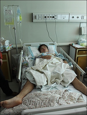 지난 5일 오후 9시 40분께 오토바이 사고를 당한 고등학생 김아무개(16)씨는 폐와 신장, 치아 등에 심각한 부상을 입었다. 고등학생 김씨는 재활치료를 포함해 6개월 동안 장기치료가 필요한 상태다.