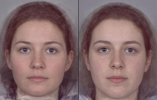 좌측은 에스트로겐 비율이 높은 얼굴형이며 우측은 에스트로겐 비율이 낮은 얼굴형이다. 
