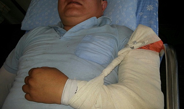 현대차 비정규직지회 한 간부가 용역경비에 폭행당해 팔 골절상을 입었다.
