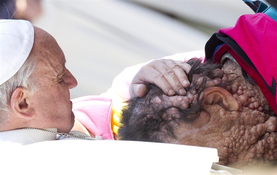 지난해 11월 3일 프란치스코 교황이 바티칸 시티 성 베드로 광장에서 열린 일반인들을 대상으로 하는 알현 행사 말미에 피부병에 걸린 사람을 껴안고 있다. 