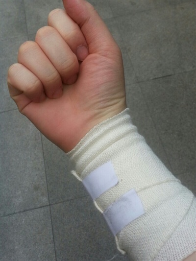 백화점 단기판매 아르바이트를 하다 손목을 다쳤다.