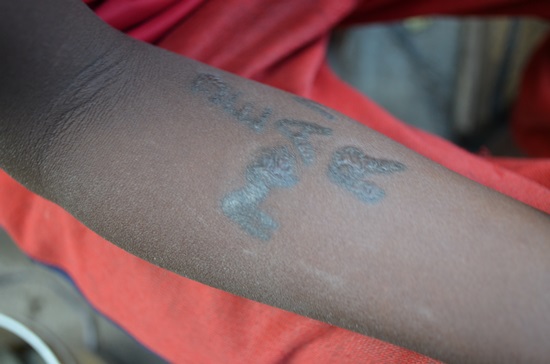 에티오피아에서 만난 한 어린이 팔에 크로스로 새겨진 'Dear mother' 글귀. 문신이라기 보다 흉터에 가까웠다.