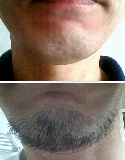 7월 1일 수염 자른 후 모습(위)와 7월 15일 털털해진 수염(아래).