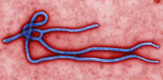 미국질병관리본부(CDC) 홈페이지의 에볼라 바이러스 사진 갈무리.