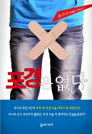 <포경은 없다>( 김대식, 방명걸 지음 / 올리브M&B 펴냄 / 2014.09 / 1만 3000원)