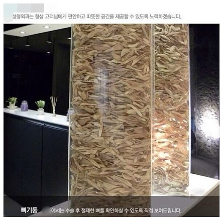  SNS에서 논란이 된 한 성형외과의 '턱뼈탑'. 강남 O성형외과 홈페이키 캡처 사진. 논란 이후에는 삭제되었다. 