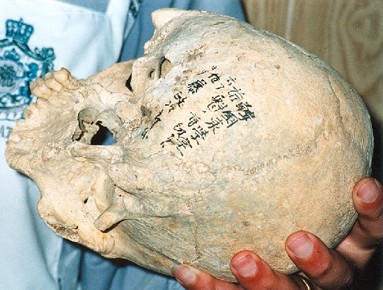 1995년 일본 홋카이도 대학에서 발견된 '韓國 東學黨 首魁의 首級(한국 동학혁명 지도자의 머리)'라고 붓글씨로 쓰여 있는 두개골