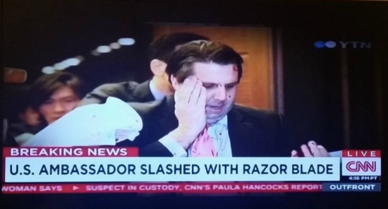 사진은 마크 리퍼트 대사의 피습 사건을 속보로 전하는 CNN 방송을 촬영한 것이다. 