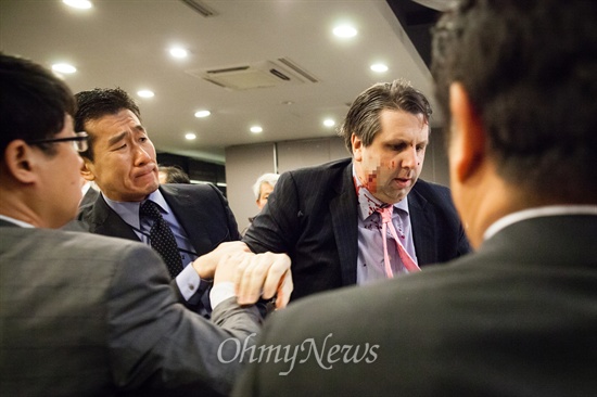 김기종 우리마당 대표가 휘두른 흉기로 인해 오른쪽 뺨에 큰 상처가 난 리퍼트 대사의 얼굴을 보며 주위 사람들이 놀란 표정을 짓고 있다. 사진가 김성헌씨가 <오마이뉴스>에 사진을 제공했다.