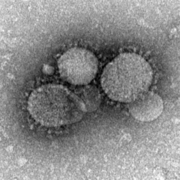 현미경에서 관찰된 중동호흡기증후군 바이러스의 모습. 