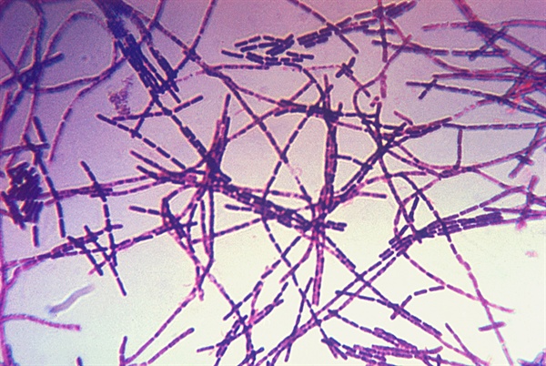 탄저균(Bacillus anthracis)