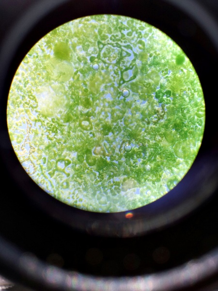 현미경으로 들여다본 남조류 '마이크로시스티스', 지난 8월 28일 일본 조류 학자들의 방한시 낙동강에서 현미경으로 들여다본 남조류다. 