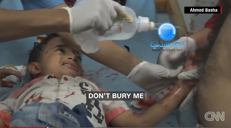 2015년 10월, 폭격 피해를 당한 예멘 소년 파리드 샤키의 영상을 전하는 CNN 뉴스 갈무리. 이 영상은 전세계로 퍼져 세계를 울렸다. 