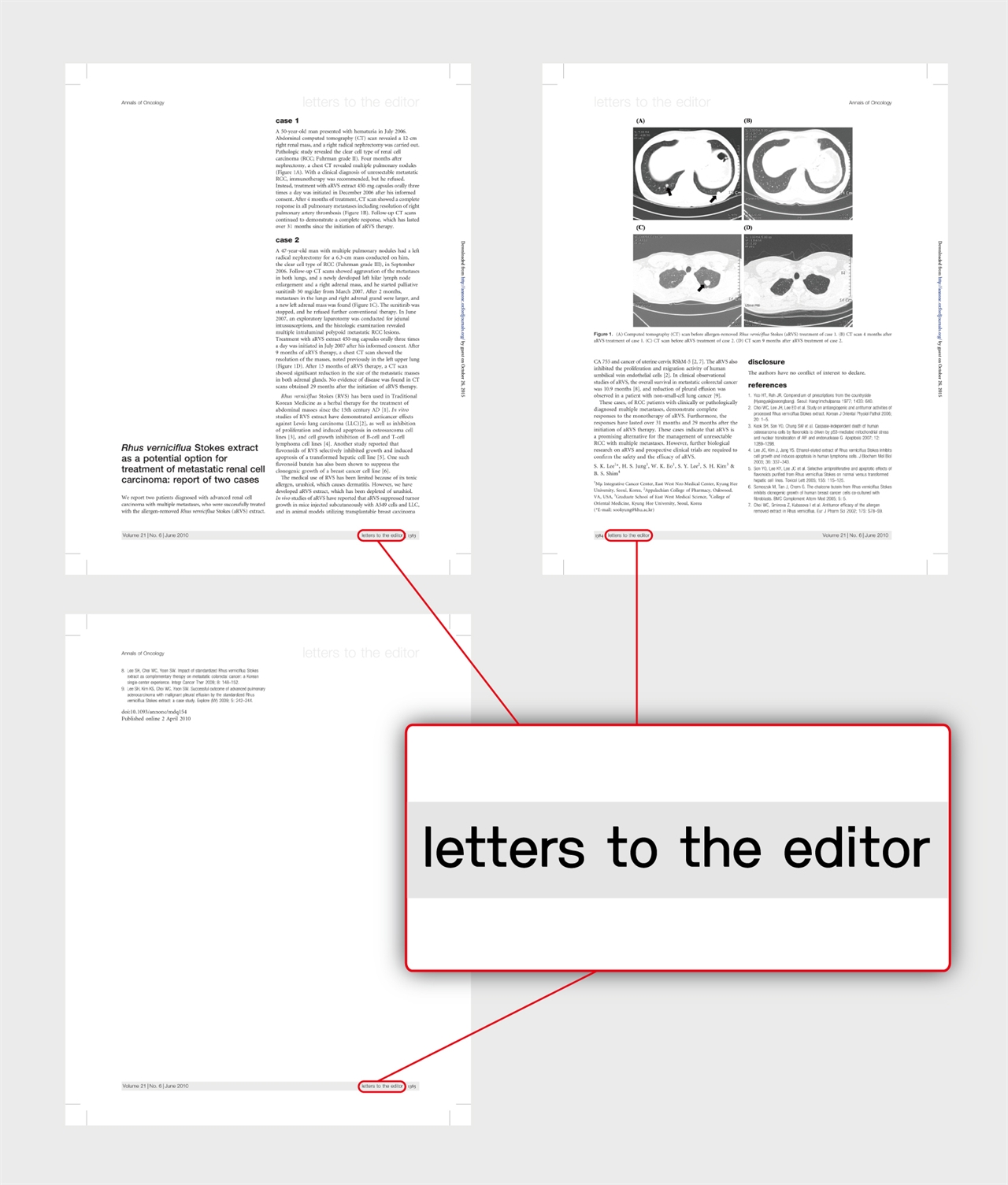 ’애널스 오브 온콜로지(Annals of Oncology)‘에 보낸 연구물은 정식 논문이 아니라 ‘편집장에게 보내는 독자편지(letters to the editor)’ 였다.