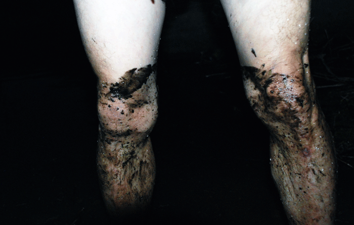 제보자의 다리에 윤활유로 보이는 시커먼 기름이 잔뜩 묻어 있다.