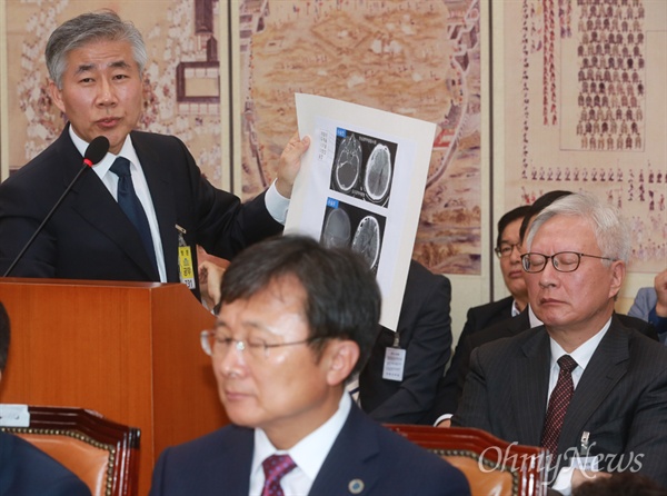  고 백남기 농민의 주치의 백선하 교수(왼쪽)가 지난 10월 11일 오전 서울 여의도 국회에서 열린 서울대학교 등에 대한 국회 교육문화체육관광위원회 국정감사에 참석해 고 백남기 농민의 CT 촬영본을 보여주며 수술 경과를 설명하고 있는 모습. (사진 오른쪽은 백 농민의 사망 원인이 '병사'가 아닌 '외인사'라고 주장하는 이윤성 특별위원회 위원장이 눈을 감은 채 백 교수의 설명을 경청하고 있는 모습.)