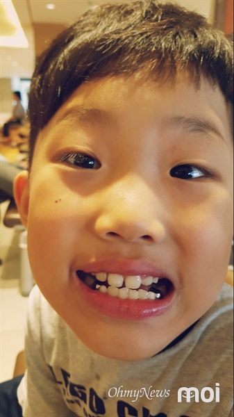 "엄마, 내 이가 하얘졌어!" 치과 치료를 받은 후 사진을 찍은 둘째 아이