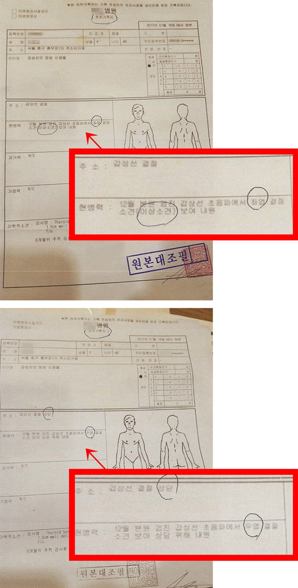  A병원에서 진료를 받은 갑상선 환자 보호자 C씨가 공개한 진료기록지. 일부 내용이 서로 다르게 기재되어있다.