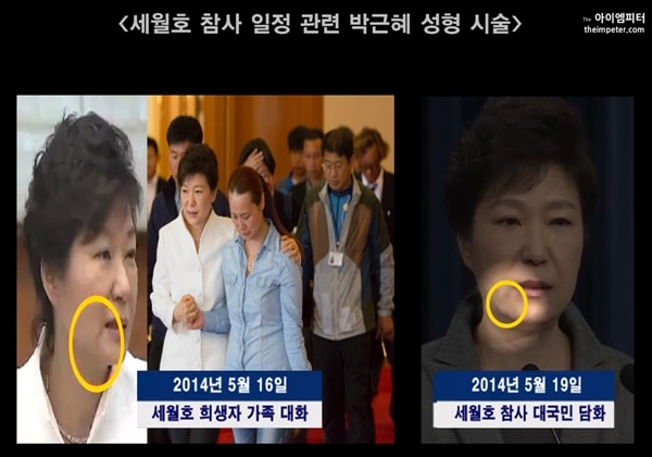 세월호 희생자 가족을 만나고 대국민사과담화를 하는 박근혜씨 얼굴에는 성형시술 흔적이 남아 있었다.