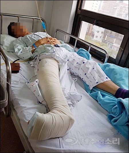  '묻지마 폭행'을 당해 병원에 입원한 김모씨. 김씨는 코뼈에 금이 가고 대퇴부가 골절되는 중상을 입었다. 피해자 가족 제공.