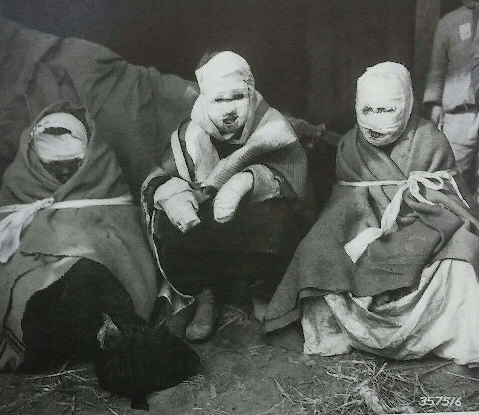 네이팜탄으로 부상을 입은 여인들. 1951년 4월 수원(출처: 박도 사진집)
