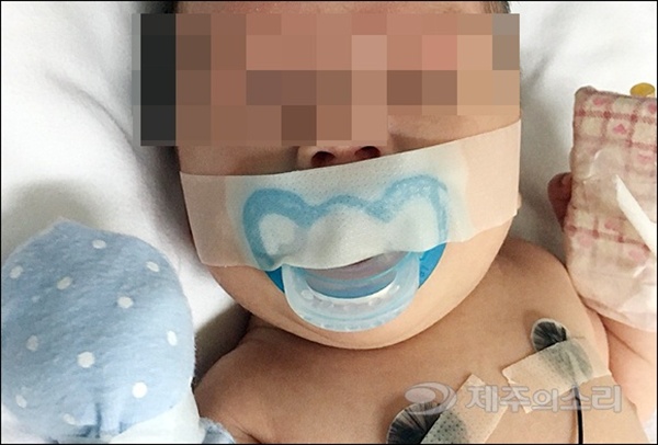 제주도내 한 종합병원 신생아 집중치료실에서 보채는 신생아를 상대로 쪽쪽이를 물리고 테이프로 막아 논란이 일고 있다. 